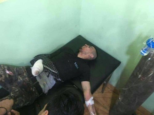 نماینده ترکمن پارلمان عراق و فرزندش در جنوب کرکوک زخمی شدند/عکس